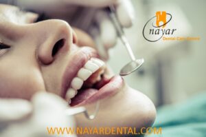 Read more about the article Best Dental Clinic in Noida +91-9999315707