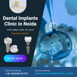 Read more about the article Dental Implants Clinic in Noida