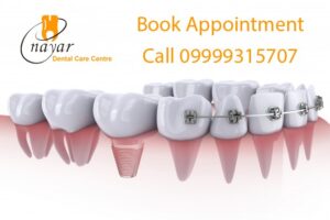 Read more about the article Best Dental Services in Noida – Implants, Braces, RCT & Family Dentistry