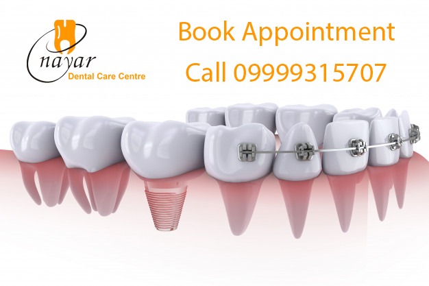 Read more about the article Best Dental Services in Noida – Implants, Braces, RCT & Family Dentistry