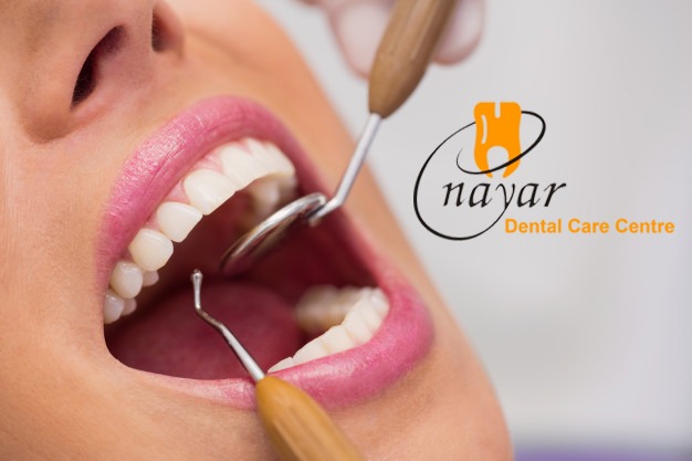 You are currently viewing Best Root Canal Treatment in Noida – Painless & Effective