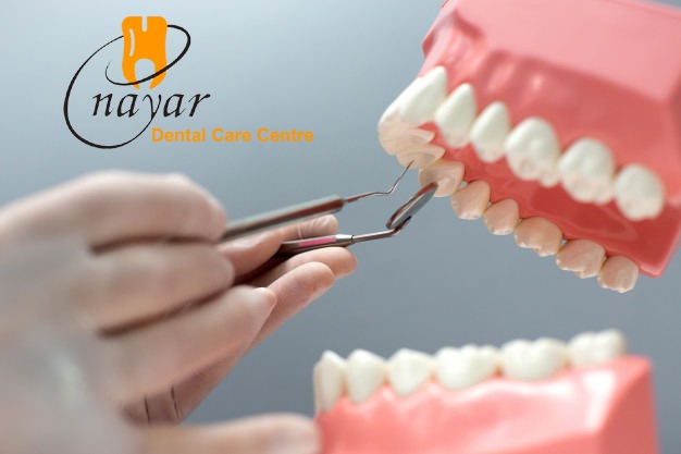 Read more about the article Best Dental Hospital in Noida +91-9999315707
