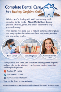 Read more about the article Best Root Canal Treatment Clinic in Noida +91-9999315707