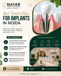 Read more about the article Best Dental Clinic for Dental Implants in Noida