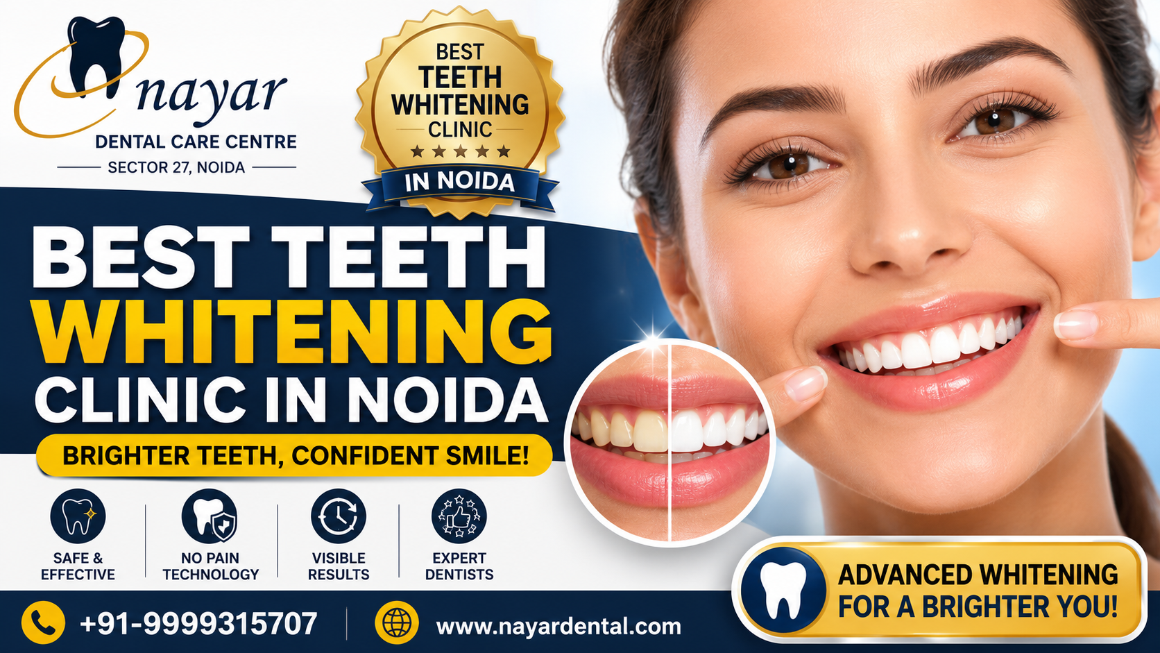 You are currently viewing Best Teeth Whitening Clinic {9999315707} in Noida